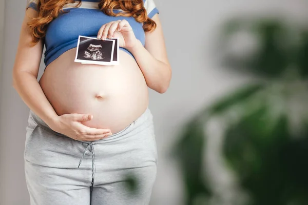 怀孕少女在家抱着超音波黑白扫描的身影 快乐的母亲在等着 — 图库照片
