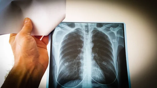 Médico Revisa Radiografía Los Pulmones Corazón Una Paciente Una Habitación — Foto de Stock