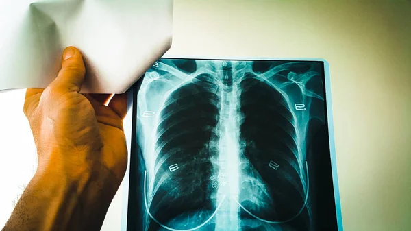 Egy Orvos Ellenőrzi Egy Női Beteg Tüdejének Szívének Röntgenfelvételét Egy — Stock Fotó