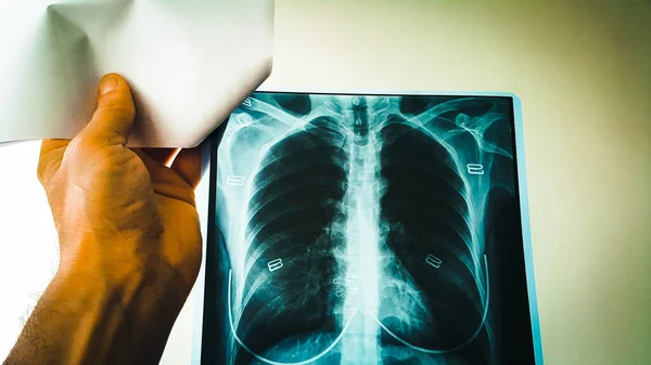 Doctor Checks Ray Film Lungs Heart Female Patient Hospital Room — Stock Photo, Image