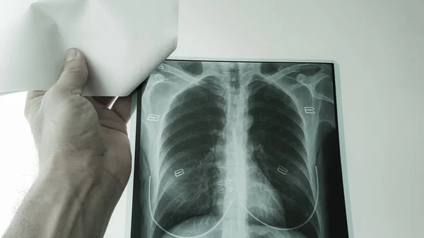 Médico Revisa Radiografía Los Pulmones Corazón Una Paciente Una Habitación — Foto de Stock