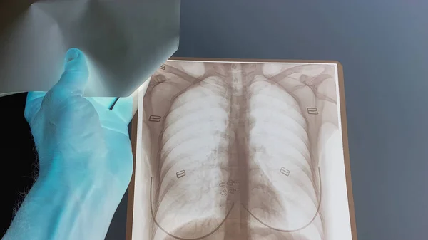 Bir Doktor Hastane Odasındaki Kadın Bir Hastanın Akciğerlerinin Kalbinin Röntgenlerini — Stok fotoğraf