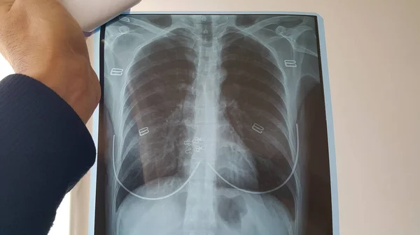 Médico Revisa Radiografía Los Pulmones Corazón Una Paciente Una Habitación — Foto de Stock