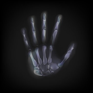 vektör x-ray el siyah arka plan üzerine.
