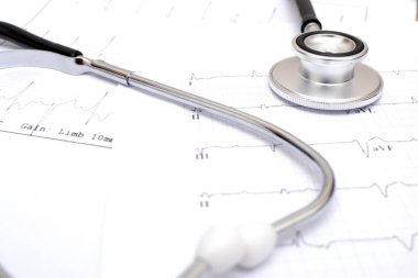 Elektrokardiyogram ve stetoskop