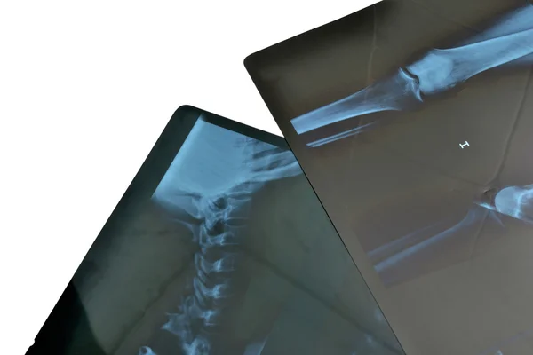 Radiographs — Stock Photo, Image