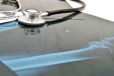 x - ray arka plan