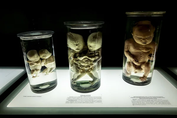 Anatomical eksponatów na wystawie "ludzkiego ciała" w St. Pe — Zdjęcie stockowe