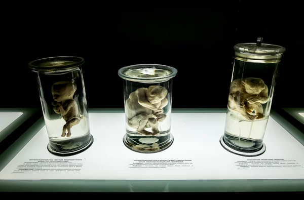 Anatomical eksponatów na wystawie "ludzkiego ciała" w St. Pe — Zdjęcie stockowe
