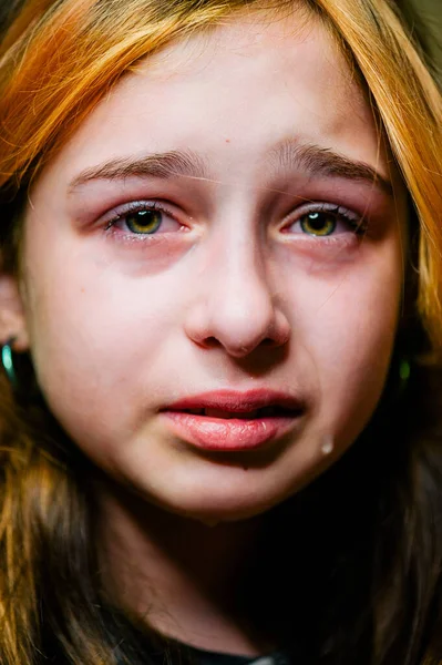 Fetiță Tristă După Plâns Plâns Fetiță Frumoasă Ochi Verzi Triști — Fotografie, imagine de stoc