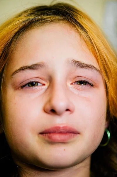 Una Niña Triste Después Llorar Niña Llorona Hermosa Con Ojos — Foto de Stock