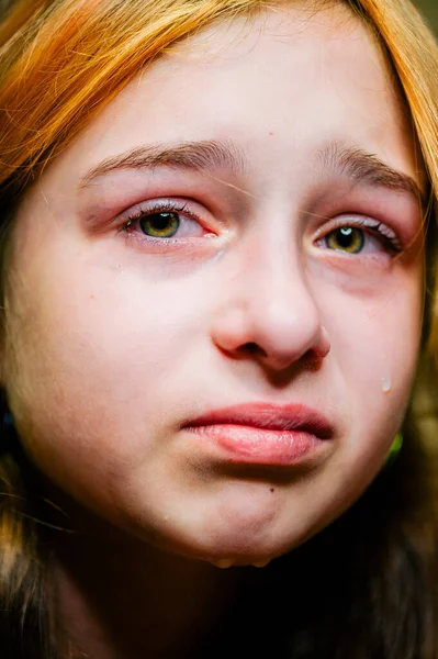 Pequena Menina Triste Depois Chorar Chorando Menina Bonita Com Olhos — Fotografia de Stock