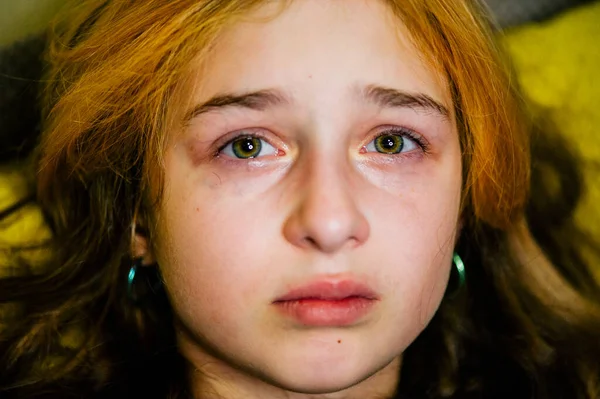 Una Niña Triste Después Llorar Niña Llorona Hermosa Con Ojos —  Fotos de Stock