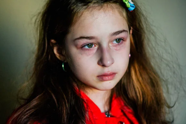 Una Niña Triste Después Llorar Niña Llorona Hermosa Con Ojos —  Fotos de Stock