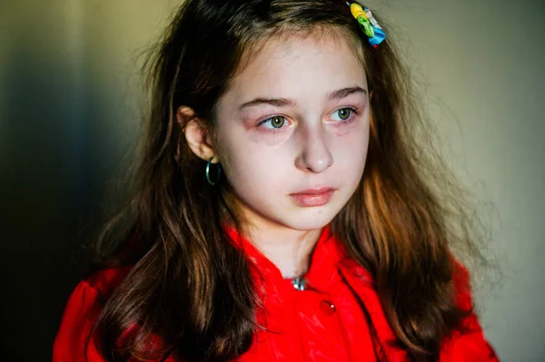 Pequena Menina Triste Depois Chorar Chorando Menina Bonita Com Olhos — Fotografia de Stock