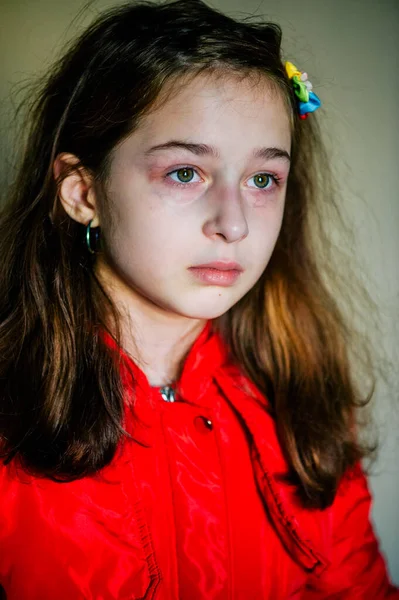 Pequena Menina Triste Depois Chorar Chorando Menina Bonita Com Olhos — Fotografia de Stock