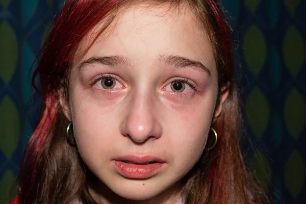 Συναισθηματικό Πορτραίτο Κακοποιημένων Εφήβων Κοντινό Πορτραίτο Ενός Νεαρού Κοριτσιού Που — Φωτογραφία Αρχείου
