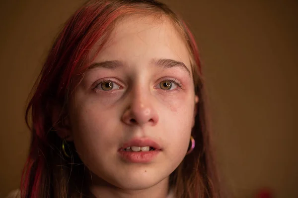 Känslomässigt Porträtt Misshandlade Tonåringar Närbild Porträtt Ung Gråtande Flicka Med — Stockfoto