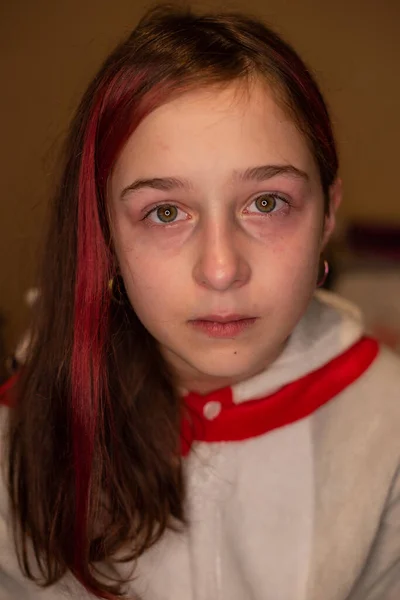 Emocionální Portrét Zneužívaného Mladistvého Velmi Emocionálního Detailní Portrét Mladé Plačící — Stock fotografie
