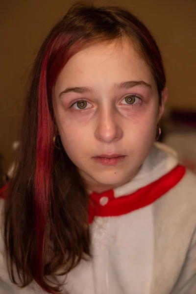 Portret Emoțional Abuzului Adolescent Emoțional Ridicat Portretul Aproape Unei Tinere — Fotografie, imagine de stoc