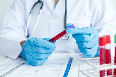 Profesyonel doktorlar virüs enfeksiyonları analizi, enfeksiyon analizi, tıbbi konseptler ve sağlık hizmetleri örneklerini tespit etmek için kan testlerinden testler yapıyorlar..