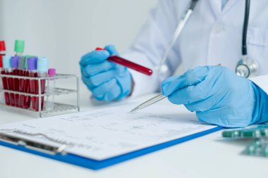 Profesyonel doktorlar virüs enfeksiyonları analizi, enfeksiyon analizi, tıbbi konseptler ve sağlık hizmetleri örneklerini tespit etmek için kan testlerinden testler yapıyorlar..