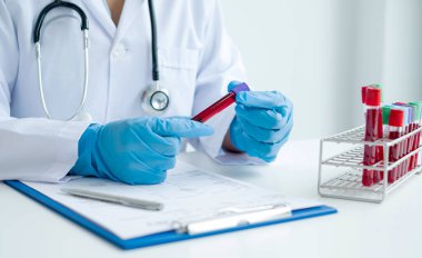 Profesyonel doktorlar virüs enfeksiyonları analizi, enfeksiyon analizi, tıbbi konseptler ve sağlık hizmetleri örneklerini tespit etmek için kan testlerinden testler yapıyorlar..