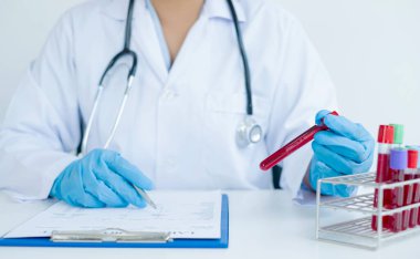 Profesyonel doktorlar virüs enfeksiyonları analizi, enfeksiyon analizi, tıbbi konseptler ve sağlık hizmetleri örneklerini tespit etmek için kan testlerinden testler yapıyorlar..