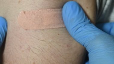 Aşıdan sonra bir kolu kapat 