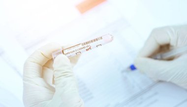 Doktor bir test tüpü kan teşhisi koydu. Laboratuvarda tıbbi teşhis koymak için.