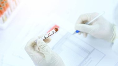 Doktor bir test tüpü kan teşhisi koydu. Laboratuvarda tıbbi teşhis koymak için.