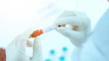 Doktor bir test tüpü kan teşhisi koydu. Laboratuvarda tıbbi teşhis koymak için.