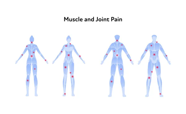 肌肉和关节疼痛信息图 矢量平面插画集 男人和女人站在蓝色的没有皮肤的轮廓与红色疼痛点 前视后视保健的设计要素 — 图库矢量图片