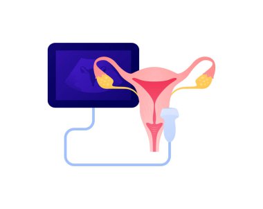 Tıbbi ultrason prosedürü konsepti. Vektör düz sağlık hizmeti çizimi. Dişi üreme sistemi ve uterus teşhis renk ikonu sembolü. Ultrasonografi cihazı sembolü. Sağlık hizmetleri için tasarım.