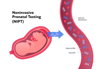 Müdahale etmeyen ebeveyn testi konsepti. Vektör düz sağlık hizmeti çizimi. Genetik test. Rahimdeki bebek, kan damarı, DNA sarmal sembolü. Sağlık, eczane, aile planlaması için tasarım