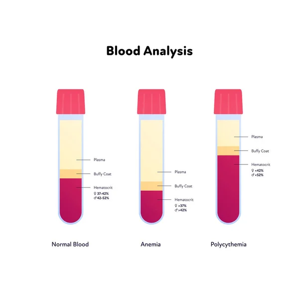 Infografía Análisis Sangre Ilustración Sanitaria Plana Vectorial Muestra Sangre Normal — Vector de stock