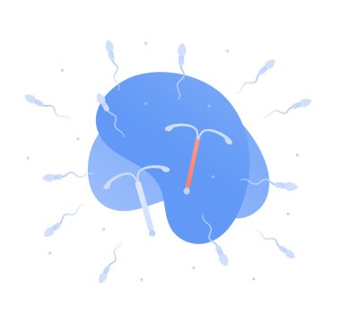 Doğum kontrol yöntemi konsepti. Vektör düz renk çizimi. Kare kompozisyon. IUD ve IUS rahim içi doğum kontrol cihazı beyaza izole edildi. Sperm sembolü. Doğum kontrolü ve hamileliği önleme.