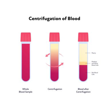 Blood analysis infographic. Vector flat healthcare illustration. Centrifugation. Whole blood sample to divided. Design for pharmacy, health care. clipart