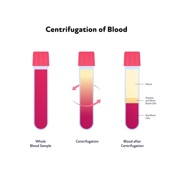 Infografía Análisis Sangre Ilustración Sanitaria Plana Vectorial Centrifugación Muestra Sangre — Vector de stock