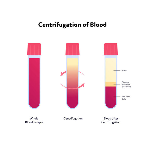 Blood analysis infographic. Vector flat healthcare illustration. Centrifugation. Whole blood sample to divided. Design for pharmacy, health care.