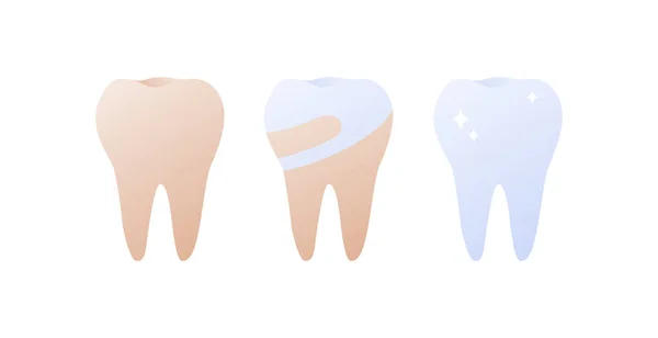 Концепція Відбілювання Зубів Чистки Стоматології Векторні Плоскі Ілюстрації Охорони Здоров — стоковий вектор