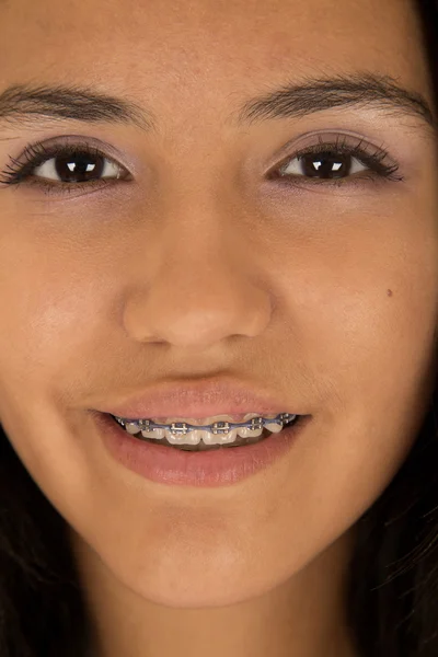 Cute Hispanic teen girl wearing braces on her teeth smiling clos — Stock Photo, Image