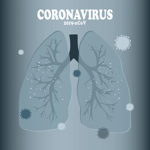 Koronavirus Kiinassa Ihmisen Keuhkoissa Virus Moderni Käsite Hengitysteiden Infektio Maailmanlaajuisesti — kuvapankkivalokuva