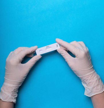 Novel Coronavirus, SARS-CoV-2 'nin IgM ve IgG antikorlarını tespit etmek için COVID-19 testi pozitif sonuç verdi. Coronavirus Express Test kartı. Mavi arka planda Covid-19 hızlı test. Coronavirus testi.