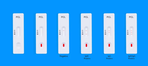 Test Covid Pour Détecter Les Anticorps Igm Igg Dirigés Contre — Photo