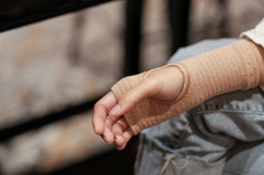 Türlerin tedavisinde doku desteği sağlamak için boru bandajı kullanan kadınlar