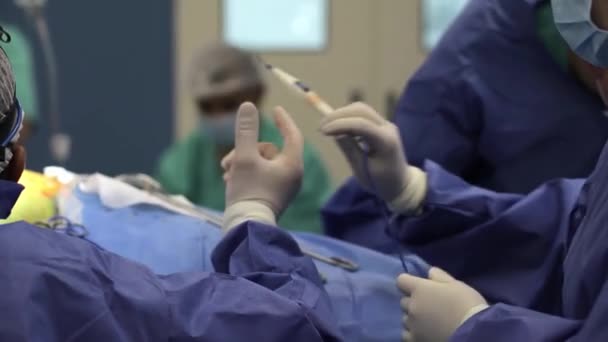 Chirurg Arzt, der mit einer speziellen Lampenbeleuchtung operiert, mit elektrischer Kauterherzchirurgie Nahaufnahme, minimalinvasive Chirurgie am offenen Nabelschnurgelenk — Stockvideo