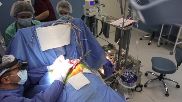 Legen bruker sterilt medisinsk utstyr under operasjonen. 4K. – stockvideo