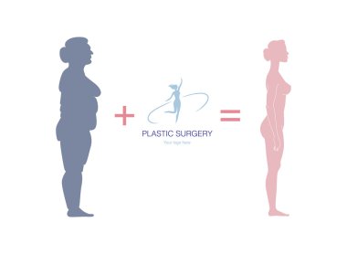 woman before and after plastic surgery clipart