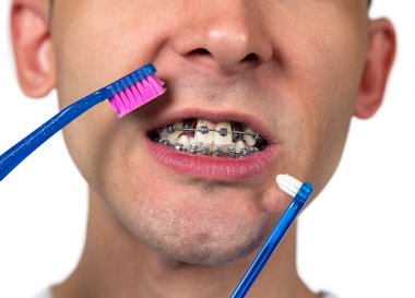 Genç adam destekleri Temizleme